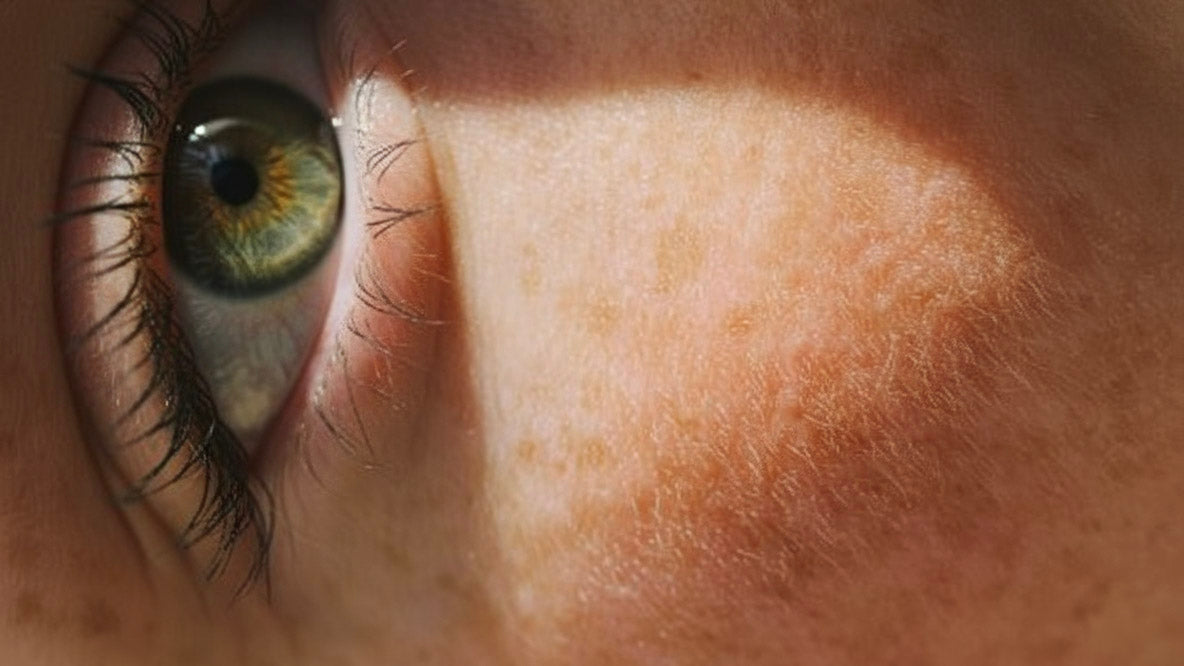 Le stress expliqué : comment le cortisol impacte votre santé mentale et physique ?